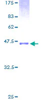 SDS-PAGE - Recombinant Human Natriuretic peptides A protein (GST tag N-Terminus) (AB114317)