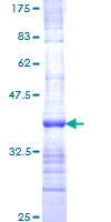 SDS-PAGE - Recombinant Human Nav1.6/SCN8A protein (GST tag N-Terminus) (AB152670)
