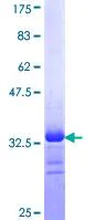SDS-PAGE - Recombinant Human Nav1.7 protein (AB114304)