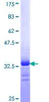 SDS-PAGE - Recombinant Human Nav1.7 protein (GST tag N-Terminus) (AB114304)