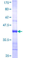 SDS-PAGE - Recombinant Human NBAS protein (GST tag N-Terminus) (AB162603)