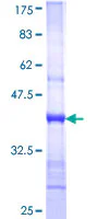 SDS-PAGE - Recombinant Human NBAS protein (GST tag N-Terminus) (AB162603)