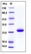 SDS-PAGE - Recombinant human NBL1 protein (His tag) (AB276217)