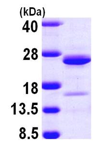 SDS-PAGE - Recombinant Human NCALD protein (AB103901), expandable thumbnail