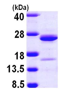 SDS-PAGE - Recombinant Human NCALD protein (His tag N-Terminus) (AB103901)