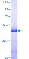SDS-PAGE - Recombinant Human NCAM1 protein (AB114198), expandable thumbnail
