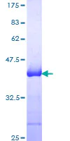 SDS-PAGE - Recombinant Human NCAM1 protein (AB114198)
