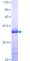 SDS-PAGE - Recombinant Human NCAM1 protein (GST tag N-Terminus) (AB114198)