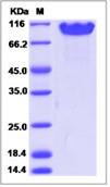 SDS-PAGE - Recombinant Human NCAM1 protein (His tag) (AB276299)