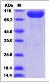 SDS-PAGE - Recombinant Human NCAM2 protein (His tag) (AB276715)