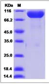 SDS-PAGE - Recombinant Human NCAM2 protein (His tag) (AB276715)