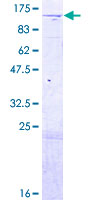 SDS-PAGE - Recombinant Human NCAPG2 protein (AB162880)