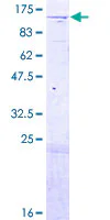SDS-PAGE - Recombinant Human NCAPG2 protein (GST tag N-Terminus) (AB162880)