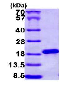 SDS-PAGE - Recombinant Human NCBP2 protein (His tag N-Terminus) (AB101195)