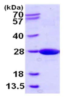 SDS-PAGE - Recombinant Human NCE2/UBE2F protein (His tag N-Terminus) (AB128456)