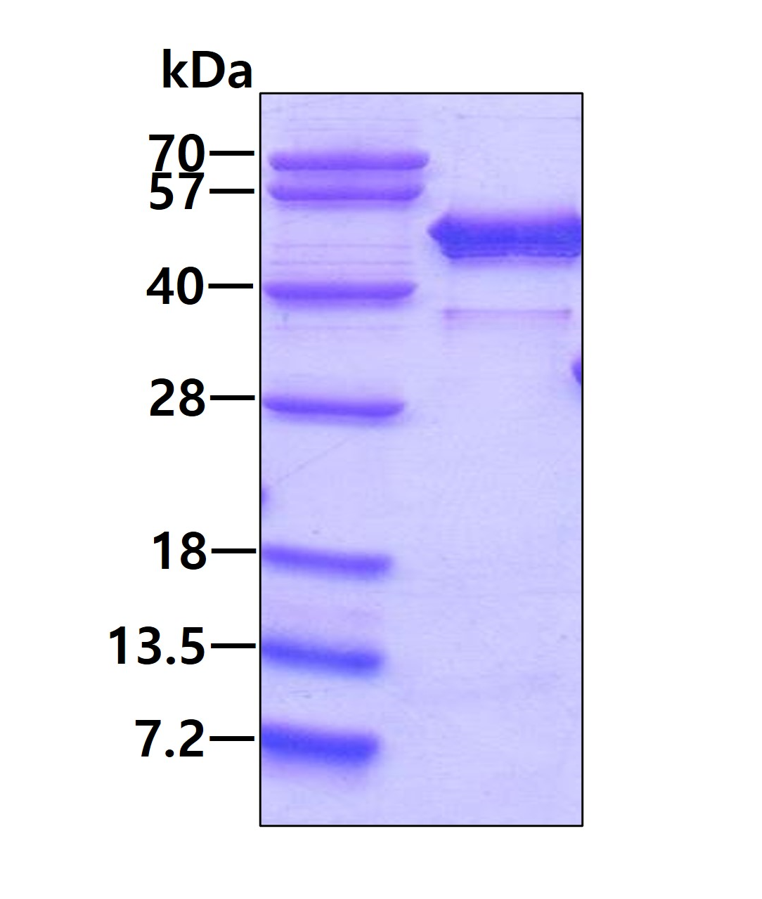 SDS-PAGE - Recombinant Human NCF1/p47-phox protein (His tag C-Terminus) (AB98054)