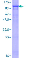 Recombinant Human NCOA4 protein