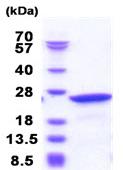 SDS-PAGE - Recombinant Human NCS1 protein (AB183224), expandable thumbnail