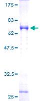 SDS-PAGE - Recombinant Human NDE1 protein (Tagged) (AB275914), expandable thumbnail