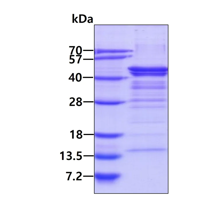 SDS-PAGE - Recombinant Human NDEL1 protein (His tag N-Terminus) (AB183232)