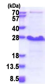 SDS-PAGE - Recombinant Human Ndfip1 protein (His tag N-Terminus) (AB174406)