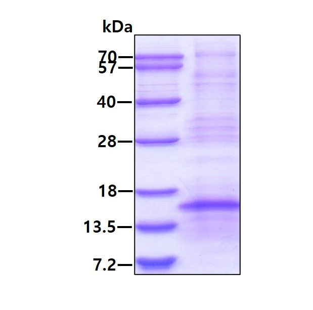 SDS-PAGE - Recombinant Human NDP protein (denatured) (His tag N-Terminus) (AB171607)