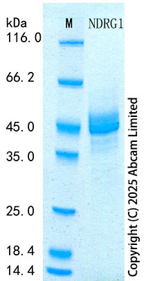 SDS-PAGE - Recombinant Human NDRG1 Protein Standard (His tag) (AB316688), expandable thumbnail