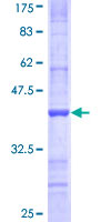 SDS-PAGE - Recombinant Human NDST3 protein (AB160446), expandable thumbnail