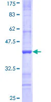 SDS-PAGE - Recombinant Human NDST3 protein (GST tag N-Terminus) (AB160446)