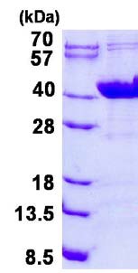 SDS-PAGE - Recombinant Human NDUFAF1 protein (AB134598)