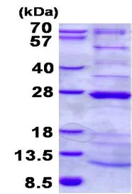 SDS-PAGE - Recombinant Human NDUFAF4 protein (His tag N-Terminus) (AB134610)