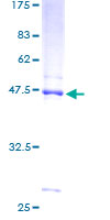 SDS-PAGE - Recombinant Human NDUFB8 protein (GST tag N-Terminus) (AB152558)