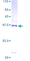 SDS-PAGE - Recombinant Human NDUFB8 protein (GST tag N-Terminus) (AB152558)