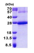 SDS-PAGE - Recombinant Human NDUFB9 protein (denatured) (AB171600), expandable thumbnail