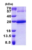 SDS-PAGE - Recombinant Human NDUFB9 protein (denatured) (His tag N-Terminus) (AB171600)