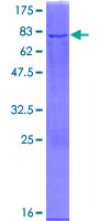 Recombinant Human NDUFS2 protein