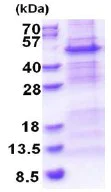 SDS-PAGE - Recombinant Human NDUFS2 protein (denatured) (His tag N-Terminus) (AB174413)