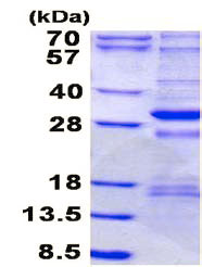 SDS-PAGE - Recombinant Human NDUFS3 protein (His tag N-Terminus) (AB136706)
