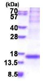 SDS-PAGE - Recombinant Human NDUFS5 protein (denatured) (His tag N-Terminus) (AB177596)