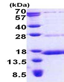 SDS-PAGE - Recombinant Human NDUFS6 protein (His tag N-Terminus) (AB167896)