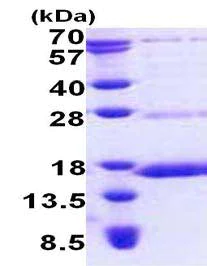 SDS-PAGE - Recombinant Human NDUFS6 protein (His tag N-Terminus) (AB167896)
