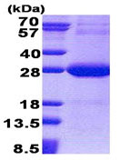 SDS-PAGE - Recombinant Human NDUFV2 protein (His tag N-Terminus) (AB171712)