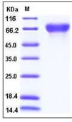 SDS-PAGE - Recombinant human Nectin 3 protein (His tag) (AB276326)