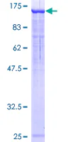 SDS-PAGE - Recombinant Human NEDD4-2 protein (GST tag N-Terminus) (AB132337)