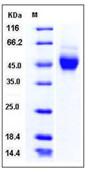 SDS-PAGE - Recombinant Human NEGR1 protein (His tag) (AB276365), expandable thumbnail