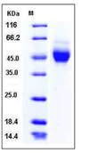 SDS-PAGE - Recombinant Human NEGR1 protein (His tag) (AB276365)