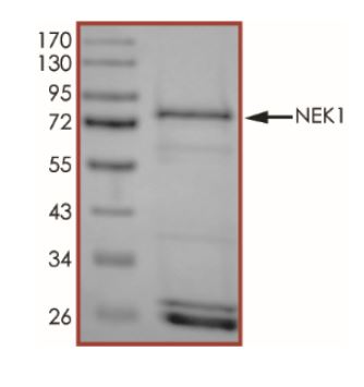 SDS-PAGE - Recombinant human NEK1 protein (Active) (AB268812), expandable thumbnail