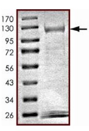 SDS-PAGE - Recombinant human NEK11 protein (AB125544), expandable thumbnail