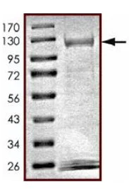 SDS-PAGE - Recombinant human NEK11 protein (AB125544)