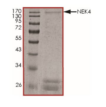 SDS-PAGE - Recombinant human NEK4 protein (Active) (AB268813), expandable thumbnail